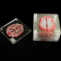 Brain Slice Coasters